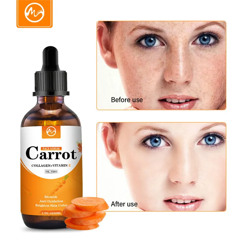 Эссенция Minch для моркови корректор темных точек отбеливающая Сыворотка лица