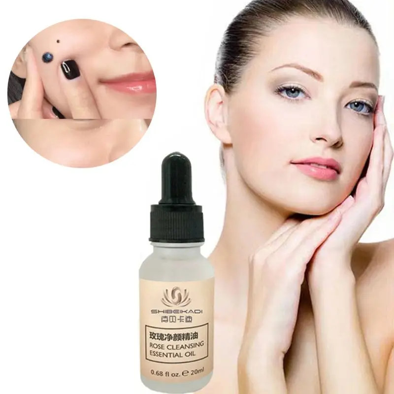 

20ml Dark Spot Mole Repair Rose Essential Oil Skin Tag Freckle Painless Removal