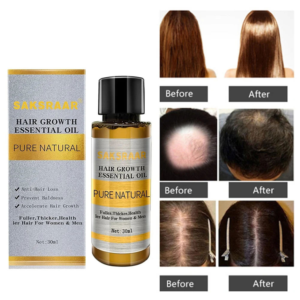 Эссенция для роста волос 30 мл масло предотвращения выпадения и облысения