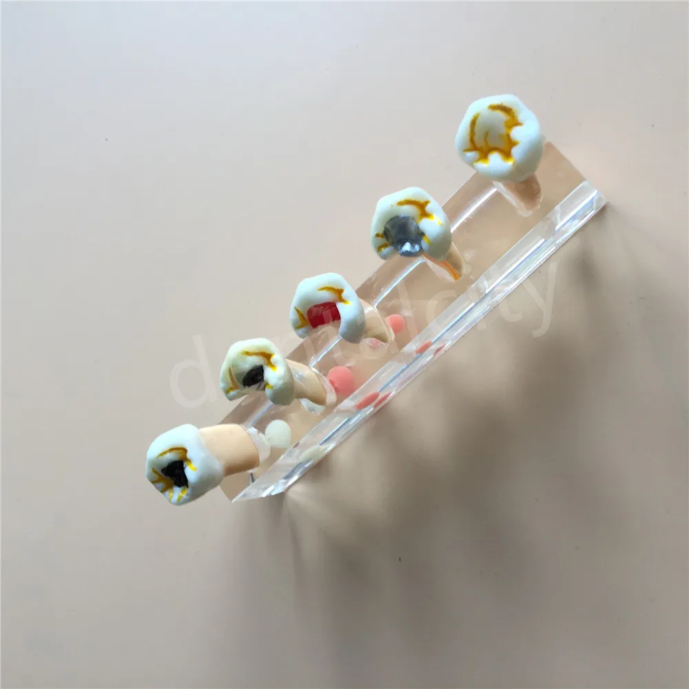 Стоматологическая 5 ступенчатая модель для лечения зубов обучения Лидер