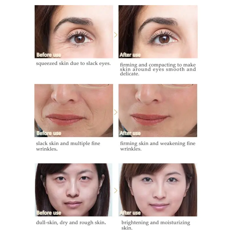 ARTISCARE морские водоросли патчи для глаз + восстановление улитки средство снятия