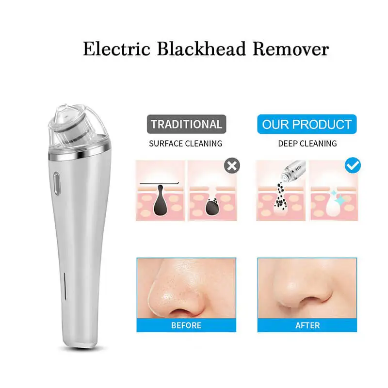 Tlinna пылесос для удаления угрей ПОР прыщей в носу алмазное удаление дермабразии