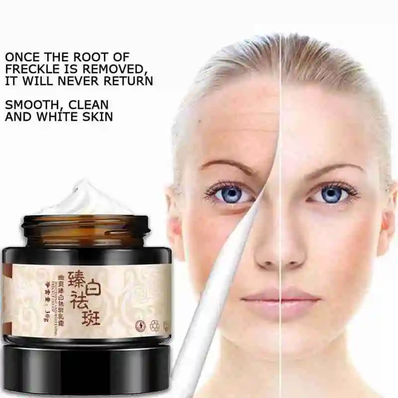 Отбеливающий крем для лица с гидрохиноном от веснушек отбеливающий увлажняющий |