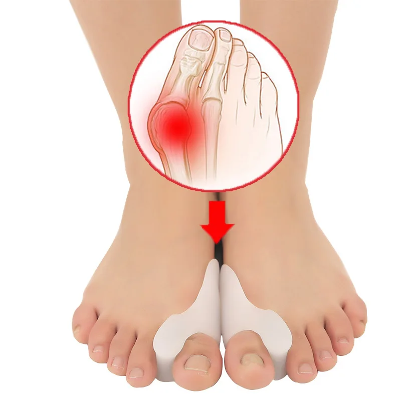 

1-4Pair Silicone Toes Separator Bone Thumb Corrector Hallux Valgus Bunion Feet Straightener Pedicure Tools Foot Care Orthosis