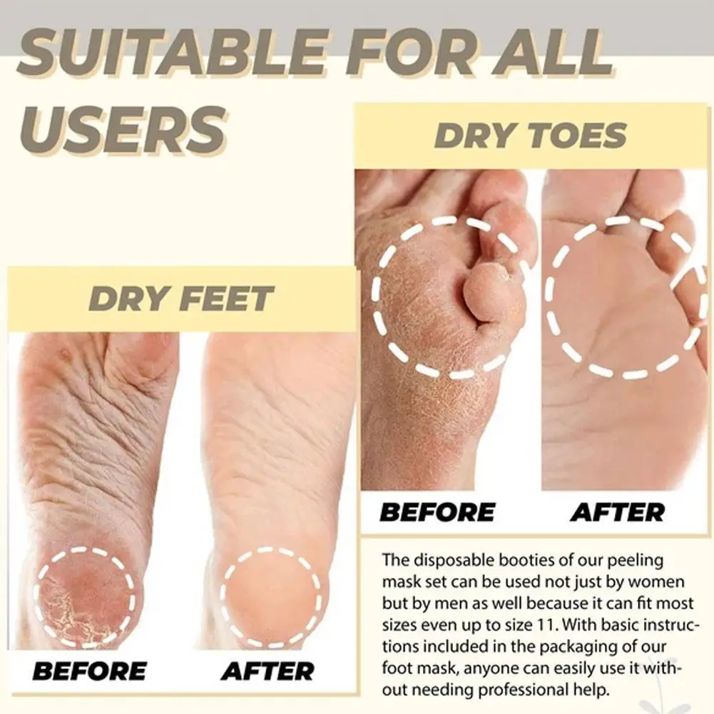 

Fruit Acid Peeling And Repairing Feet, Moisturizing, Exfoliating, Exfoliating, Whitening And Smoothing Foot Mask And Foot Patch