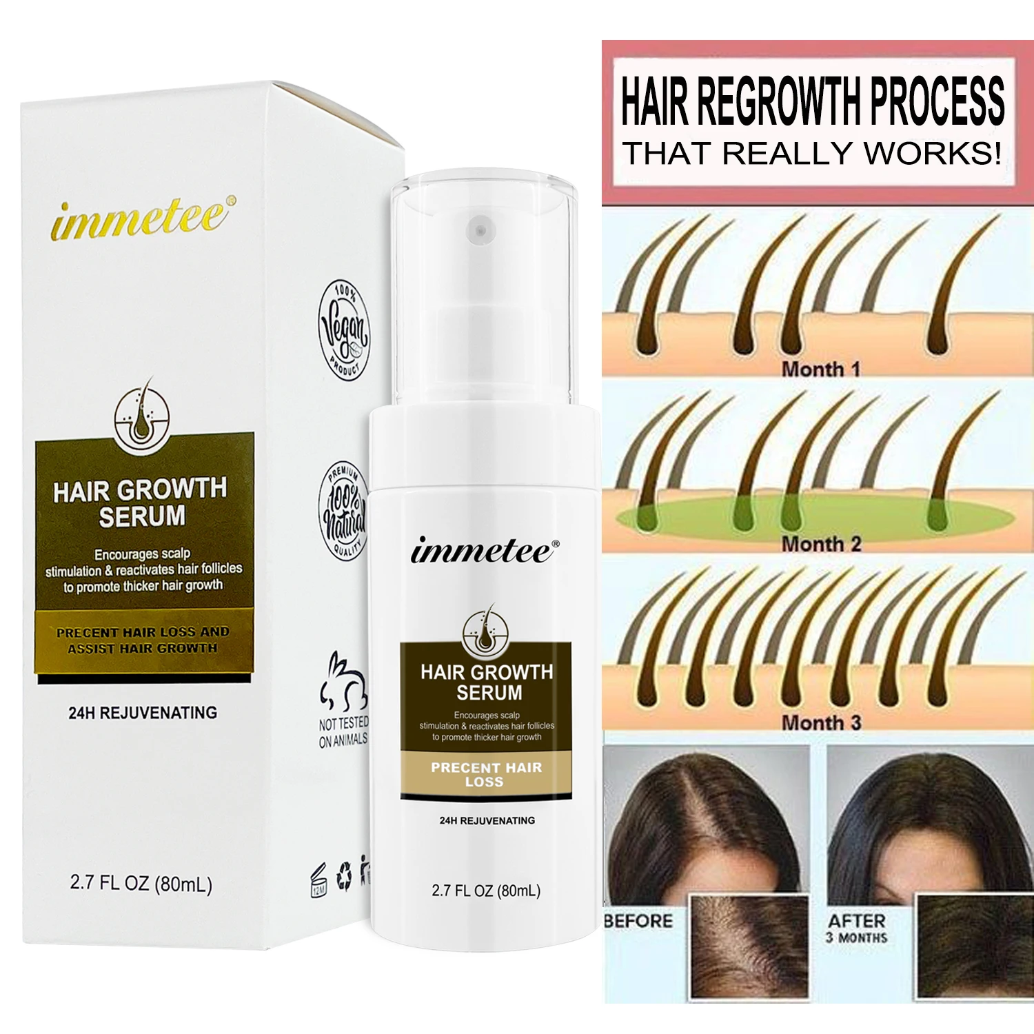 Spray per la crescita rapida dei capelli per uomo/donna essenza di siero germinazione trattamento naturale per la perdita dei capelli prodotto riparazione efficace addensare i capelli