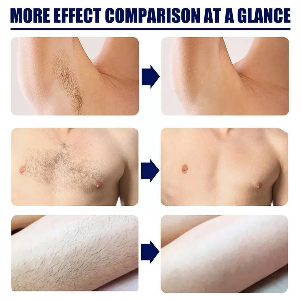 

Male Hair Removal Cream Body Cream Hair Depilatory Skin Painless Permanent Hair Remover Care Legs Cream For Men Beard Armpi I9Q1