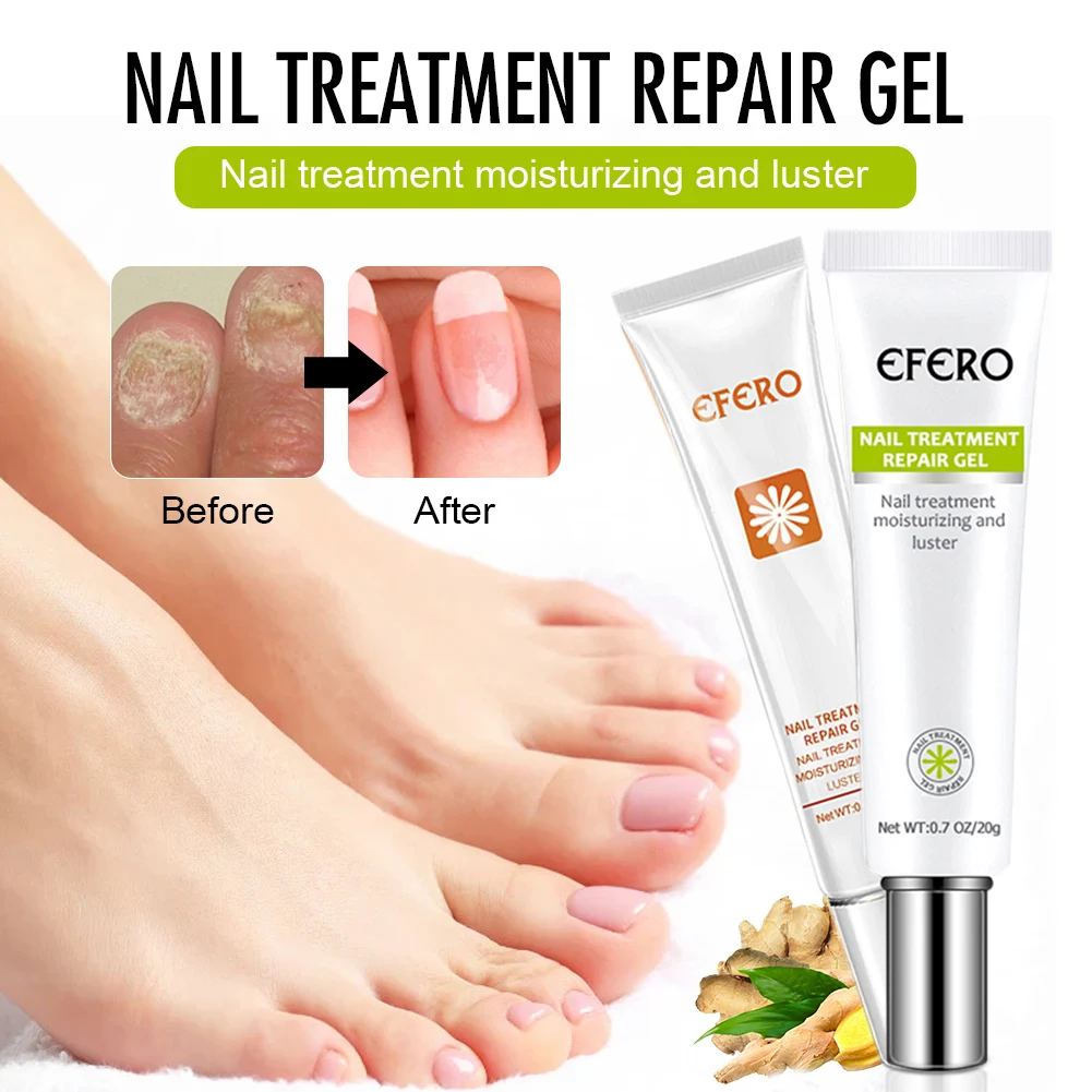 

Nail Repair Cream Nail Fungus Removal for Damaged Cracked Nails Anti-Infection Nail Nourishing Treatment for Fingernail Toenail