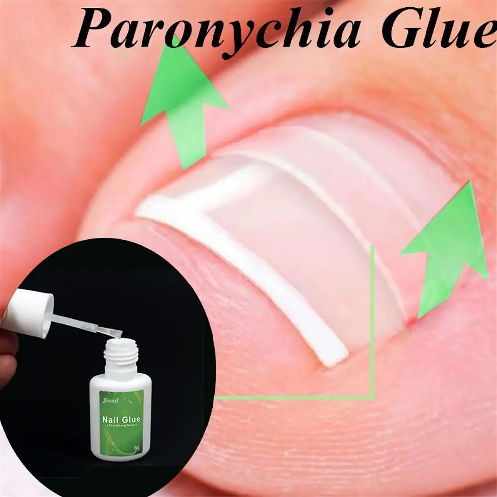 

Paronychia Nail Glue Ingrown Toenail Correction Pedicure Toe Patch Foot Care 8g Nail Art & Tools