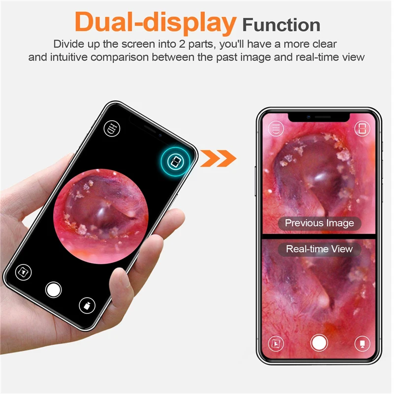 LIMINK 3 9 мм HD Ушная камера WiFi труба со светодиодными лампами ушной эндоскоп Otoscope для