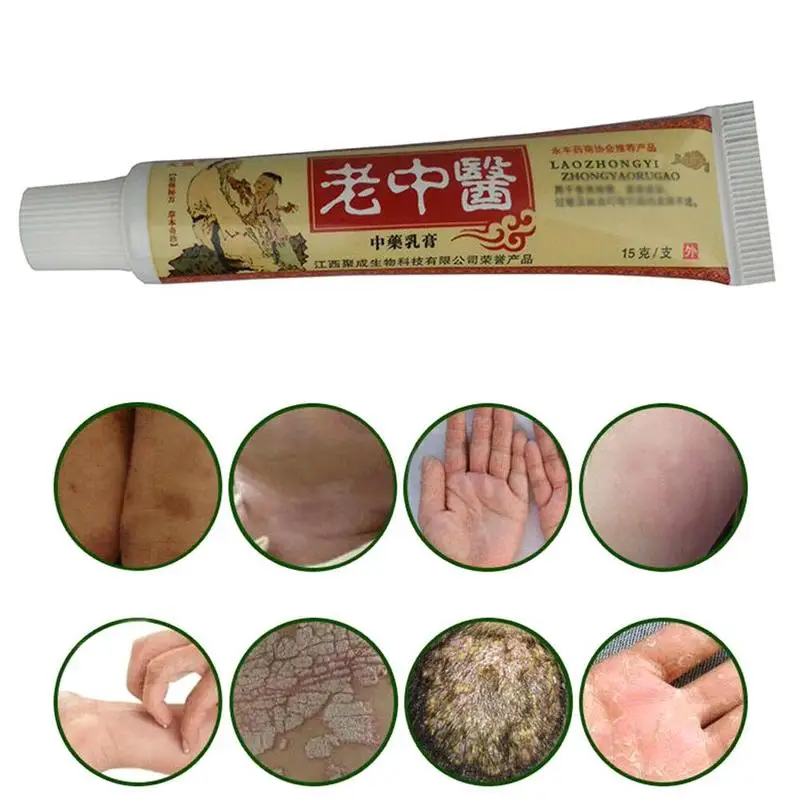 

Chinese Anti-inflammatory Fungal Infection Sterilization Effectively Itchy Care For Anti-itch Clean Treatment Cream Skin Re X2F4