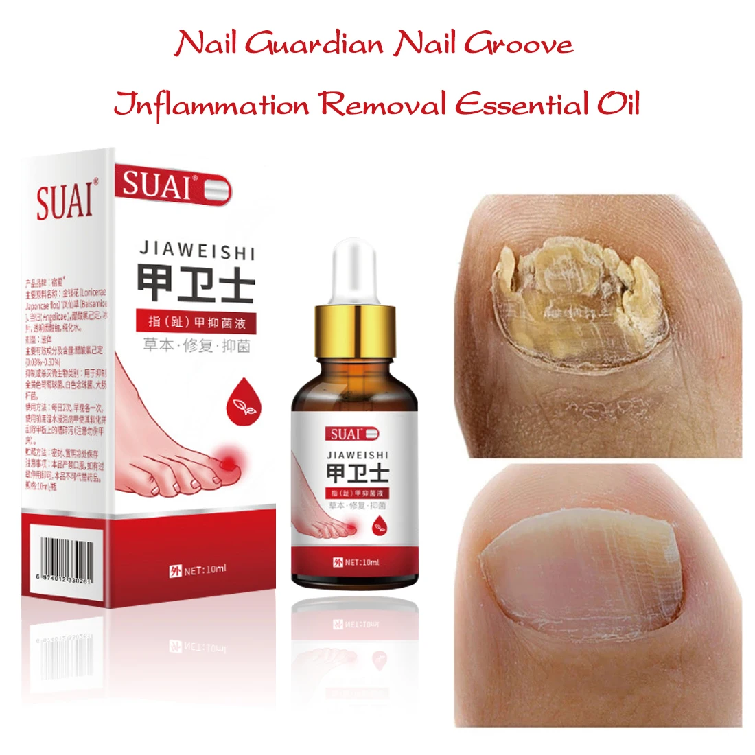 

2 bottle Nail Fungal Treatment Feet Care Essence Foot Whitening Toe Fungus Removal Gel Anti Infection Paronychia Onychomycosis