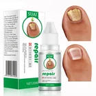 Лечение грибка ногтей 20 мл, уход за ногами, Эссенция от грибков ногтей, восстановление ног, удаление пальцев ног, гель против инфекции, паронихия онихомикоси