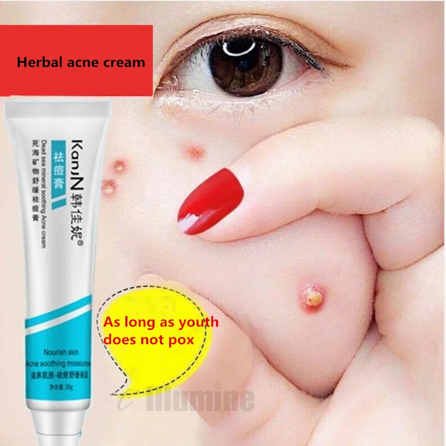 

Крем для ухода за акне, 30 г