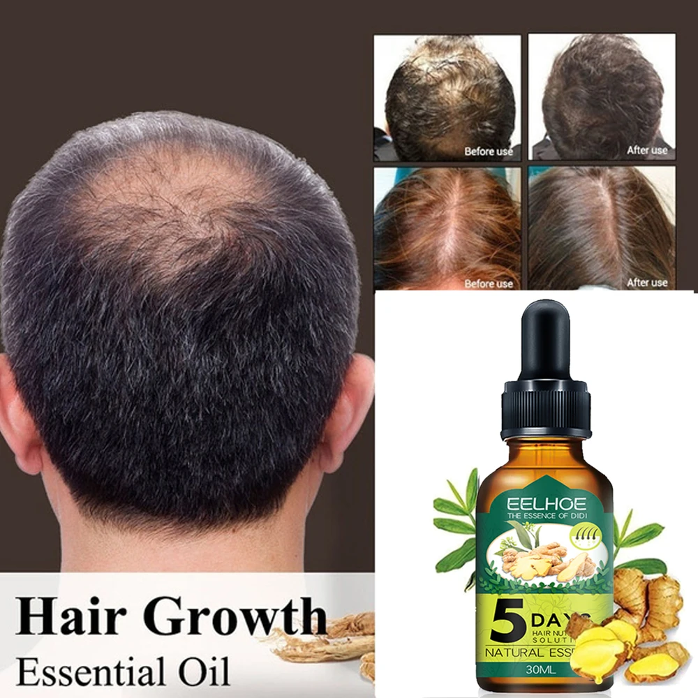 Эссенция для роста волос масло продукты быстрого уход за кожей головы лечение