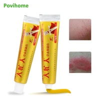 15gpc herbal skin ointment antipruritic cream relief itching external chinese medical ointment for rash swelling treatment
