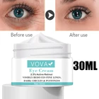 Увлажняющий крем для век мгновенный устранение мешков под глазами, Eye Gel анти-морщинки для ухода за областью вокруг глаз против тёмных кругов, мешков, темных кругов под глазами Антивозрастной уход за глазами