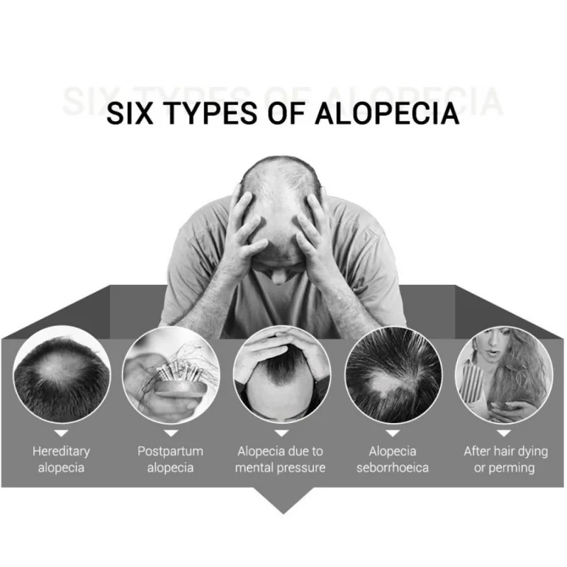 Эссенция для роста волос продукты выпадения Эфирное Масло жидкое лечение