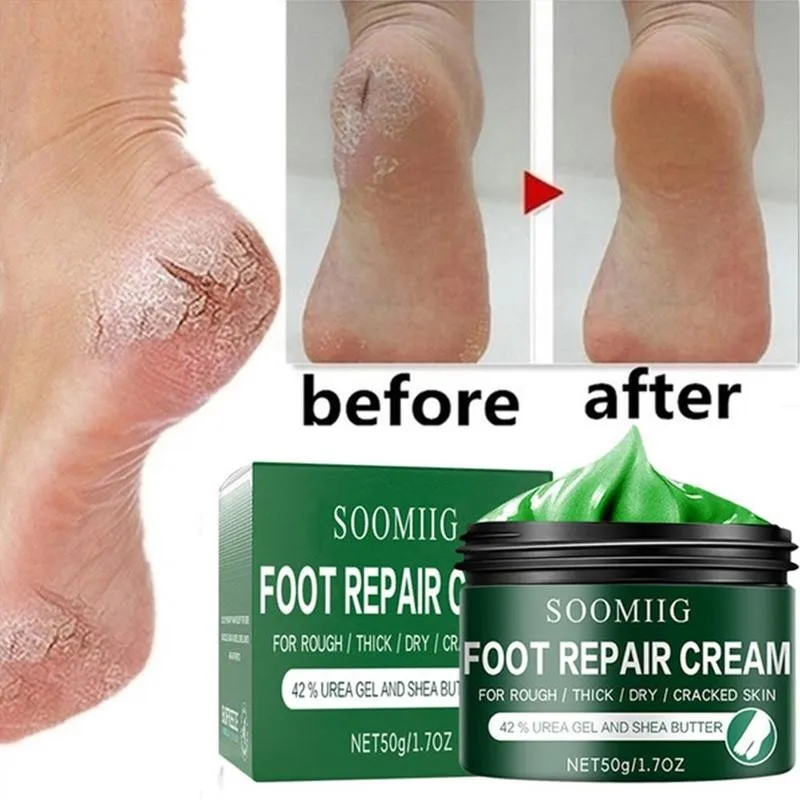 

Foot Massage Exfoliating Cream Dead Skin Remover Whitening Smooth Moisturizing Anti Feet Care Cream
