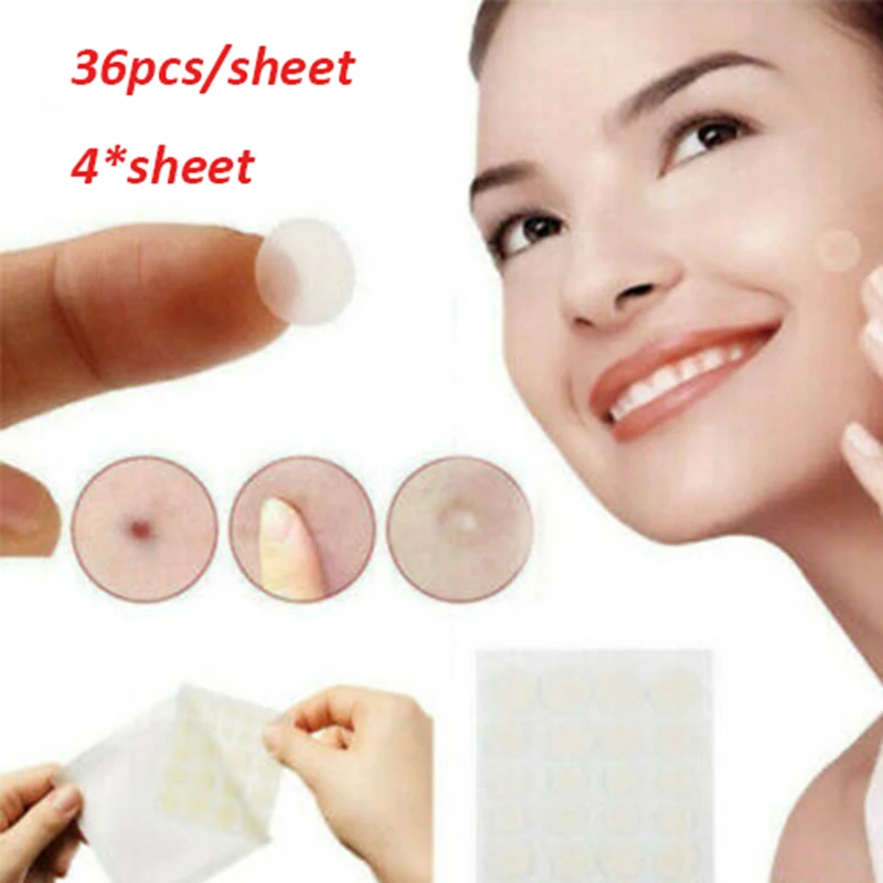 4 сумки 144 шт. наклейки для кожи средство удаления прыщей акне крем