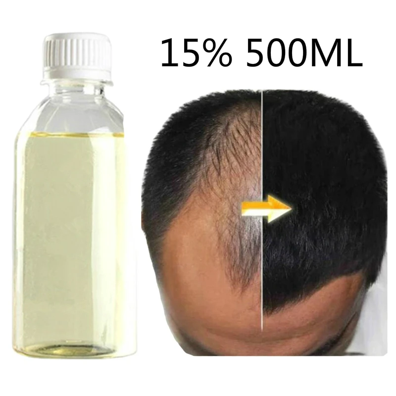 

Big Size Organic Essential Oil M15% Herbal Hair Growth Oil Hair Regrowth Serum Hair Loss treatment