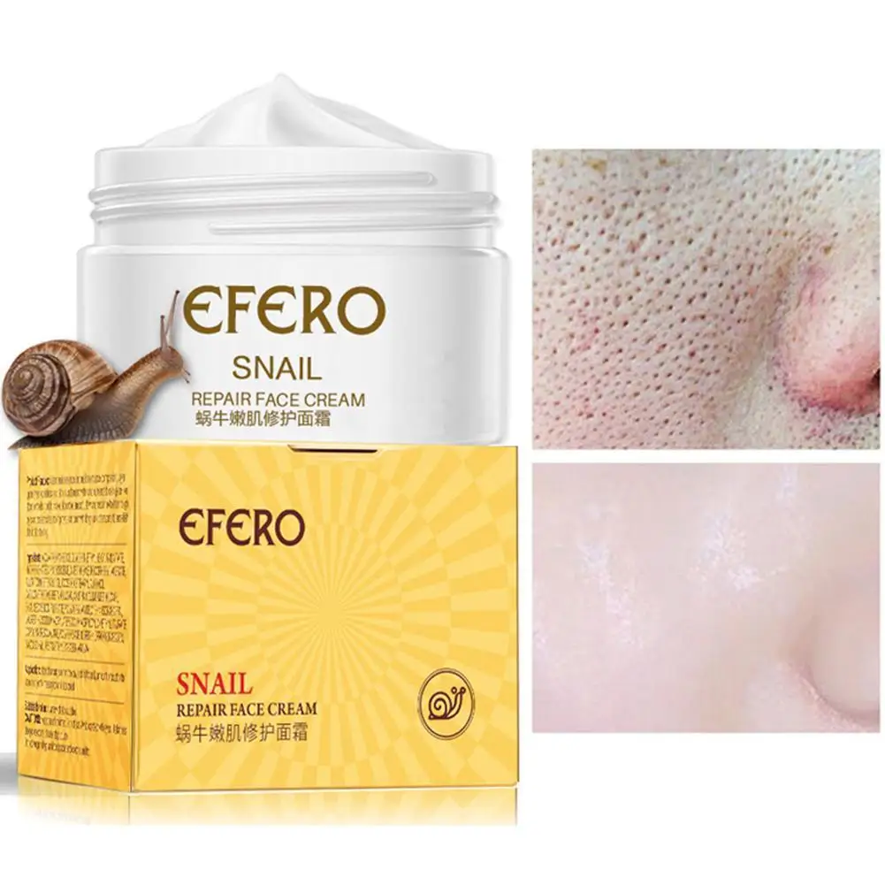 

30ml Snail Skin Rejuvenation Cream To Shrink Pores Brightening Repairing Moisturizing And Essence Cream Whitening L4L9