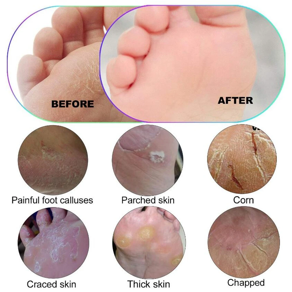 

1pc Stainless Steel Foot File Pedicure Tools Foot Rasp Scraper Callus Dead Skin Remover Feet Blade Replaceable Foot Care Brush