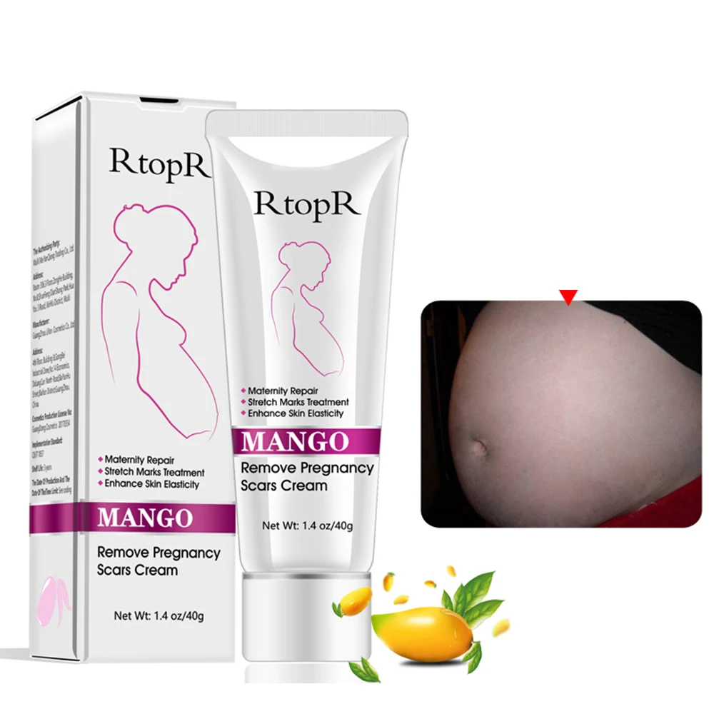 

RtopR 40ml манго стрейч Знаки крем для удаления беременности и родам ремонт лечение против отбеливающие твердой кожи и устранить Беременность ш...