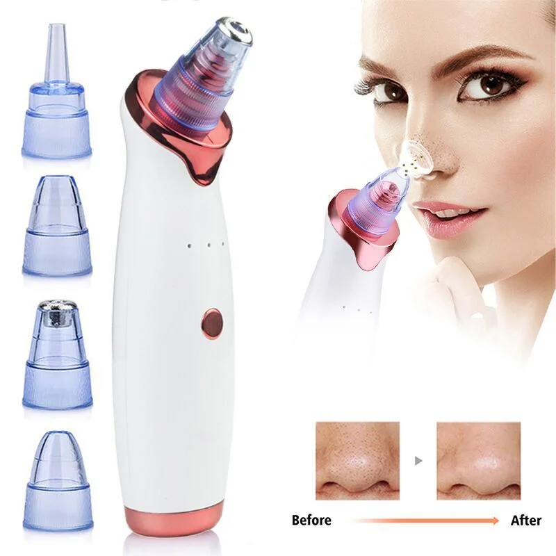 

Blackhead Remover Vacuum, Blackhead Vacuum Usb Rechargeable Facial Vacuum Extractor Tool Pore Vacuum Cleaning Suction Tool