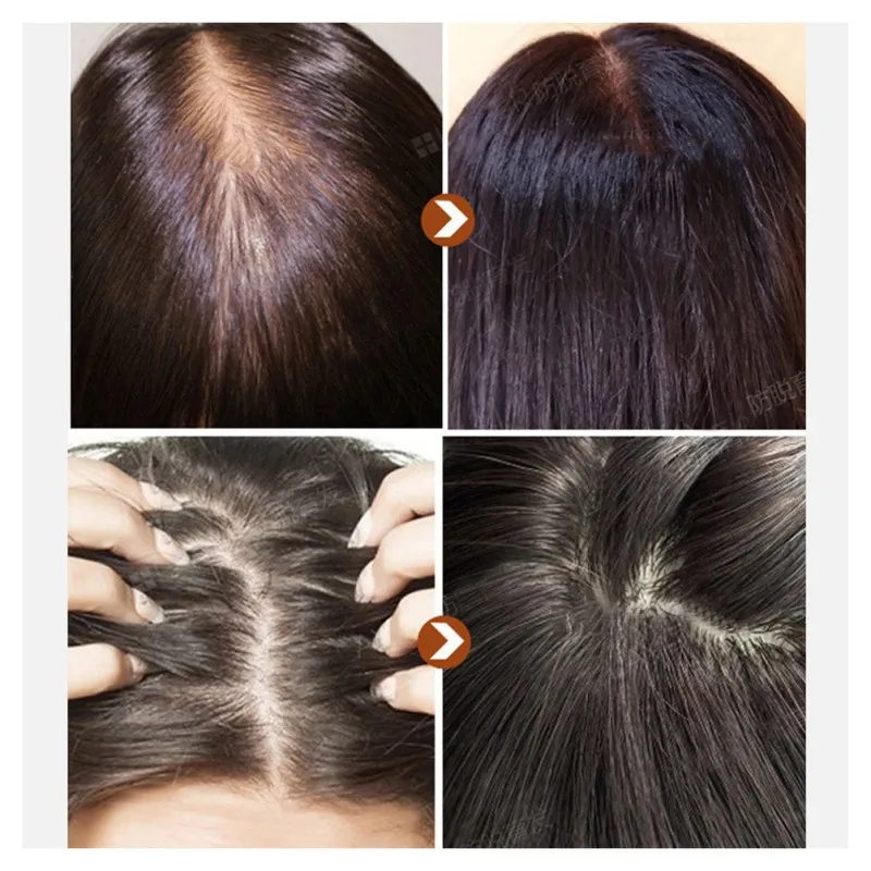 Hair Growth Essence Spray Growth Oil Preventing Baldness Anti Hair Loss Hair Care Nourishing Enhancing Hair Roots