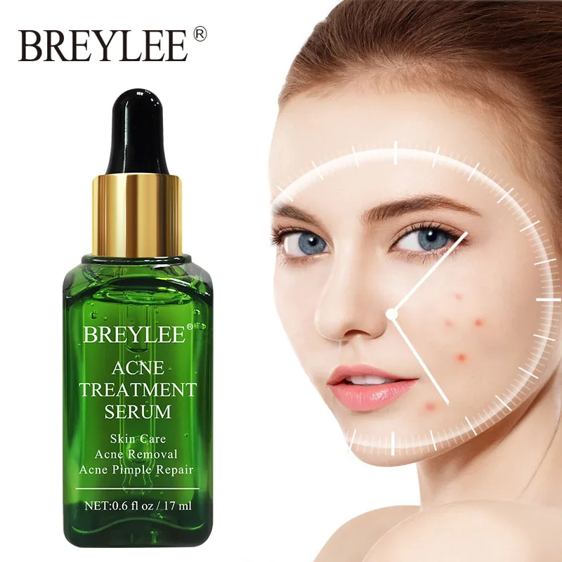 

BREYLEE Acne Treatment Face Serum Anti Acne Pimple Scar Remover Moisturizing Oil-Control Whitening Shrinking Pores Essence