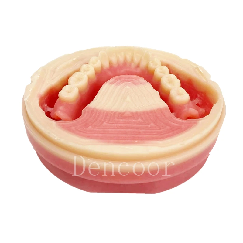 Ivotion Disc Milled Digital Denture System Vivadent  lvoclar Monolithic Removable Dental Lab Product