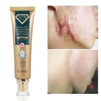 acne scar removal cream body skin care repair stretch marks herb gel nicotinamide moisturizing whitening cream beauty cosmetics