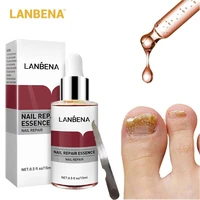 lanbena nail repair essence fungal nail treatment serum onychomycosis paronychia nail fungal removal anti infection nail care