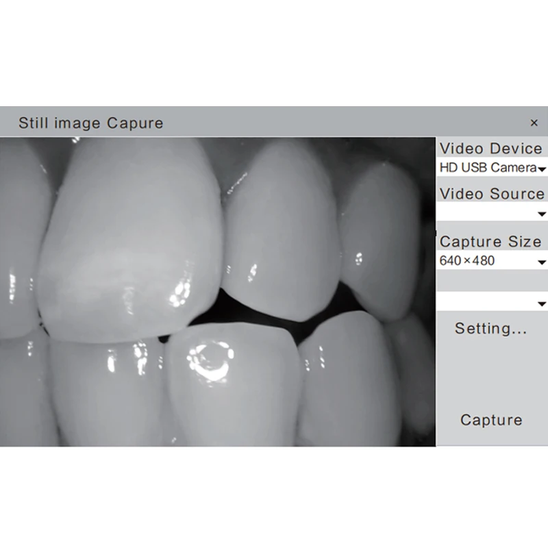 

High Quality Dynamic 4 Mega HD Pixels 6-LED Dental Intraoral Intra Oral Camera USB 2.0 Free shipping