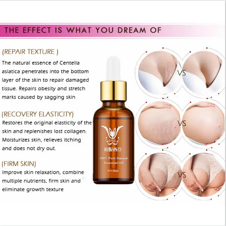 Чистый Натуральный Крем Для Удаления растяжек мощное средство для удаления