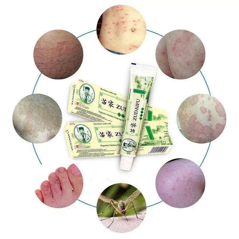 

Dropshipping Zudaifu Skin Psoriasis Cream Dermatitis Eczematoid Eczema Ointment Treatment Psoriasis Cream Skin Care Cream