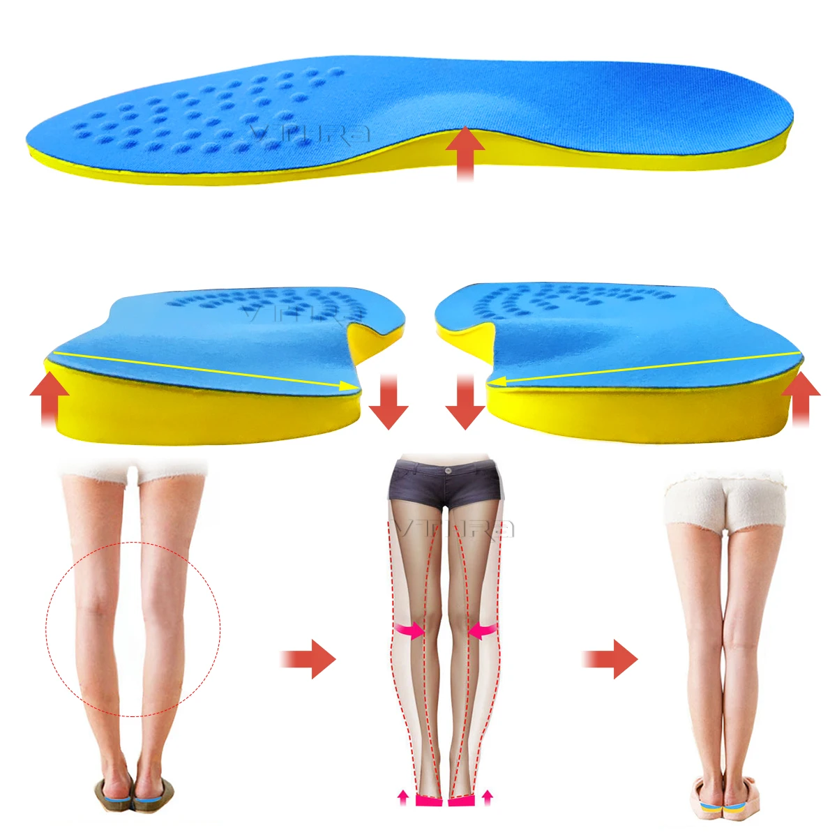 1 Pair O/X Leg Orthopedic Insoles Correction Shoe Inserts For Foot Alignment Knock Knee Pain Bow Legs Valgus Varus Feet Care | Обувь