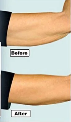 Сумка OPP тонкая лента для рук делает руки более прочными и молодыми формирует