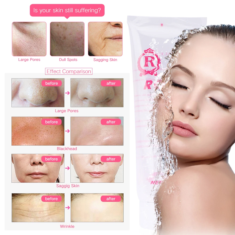 Новинка 300 мл ультразвуковой крутой омоложение кожи укрепляющий отбеливающий