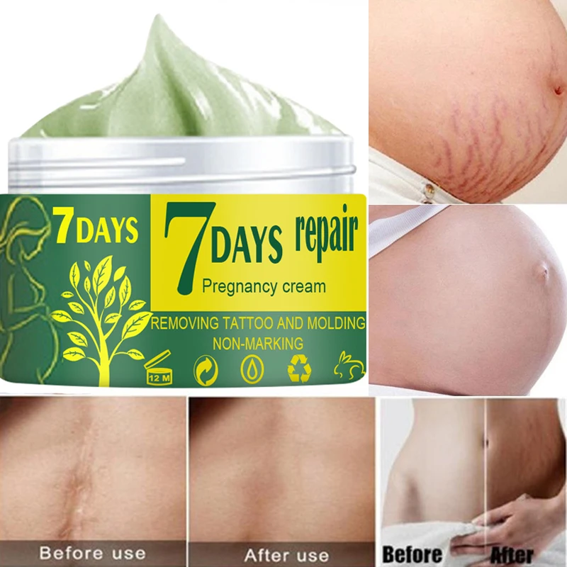 

Восстанавливающий Крем для беременных, от растяжек, акне, шрамов, лечение беременности, восстановление кожи, тела, отбеливающий крем 10/30/50 г