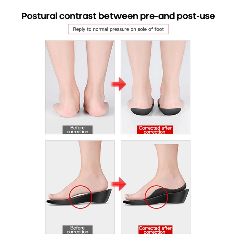 Unisex Flatfoot Orthotics Cubitus Varus Orthopedic Feet Cushion O-shaped Legs Pads Care Insoles TPR Large | Обувь