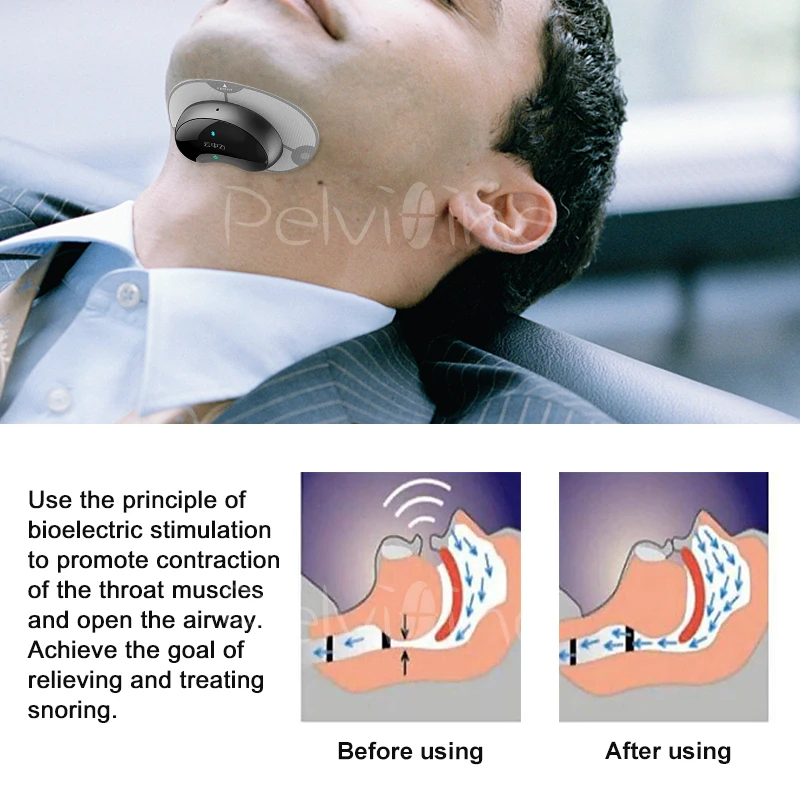 Смарт-стоп биодатчик храпа апноэ сна устройство против храпа Спящая помощь с управлением приложения и монитор сна устройство помощи сна