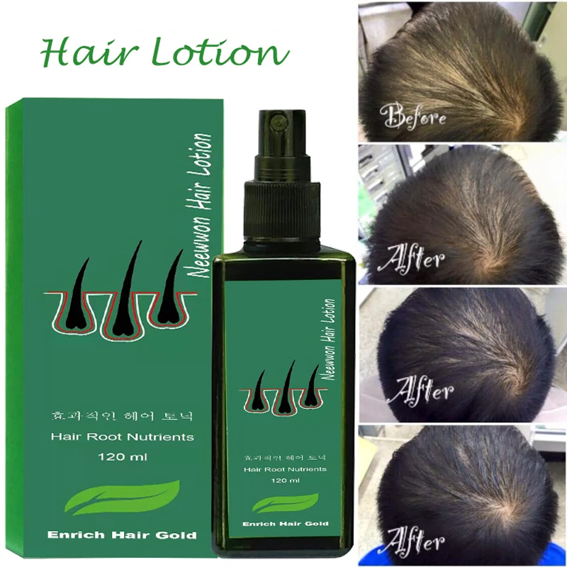 Лосьон Neewwon средство для быстрого роста волос спрей против выпадения корни 120 мл