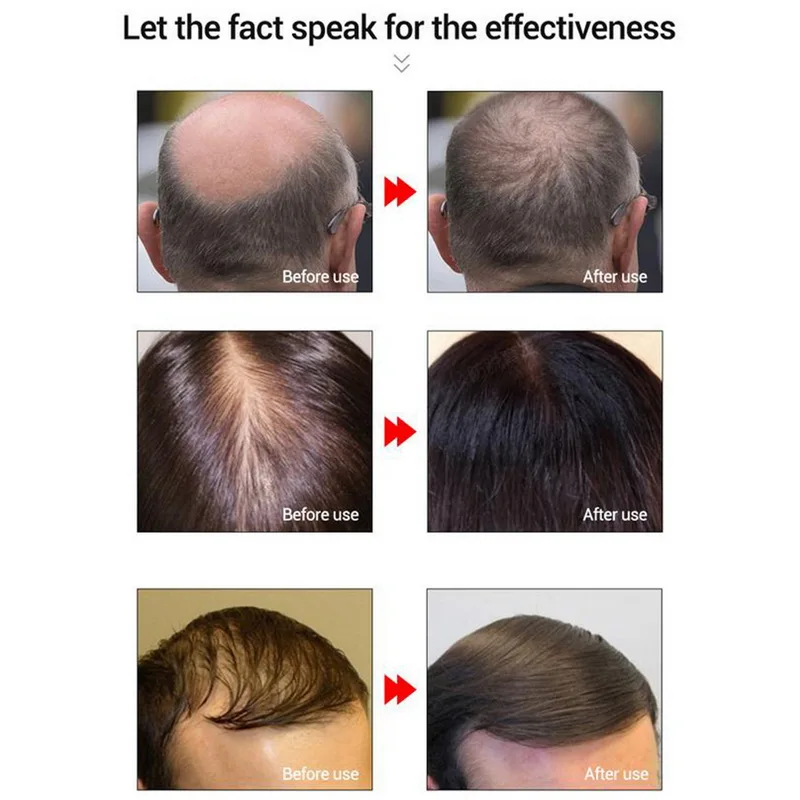 LANBENA 20 мл эссенция для роста волос быстрый мощный Уход за волосами эфирное масло