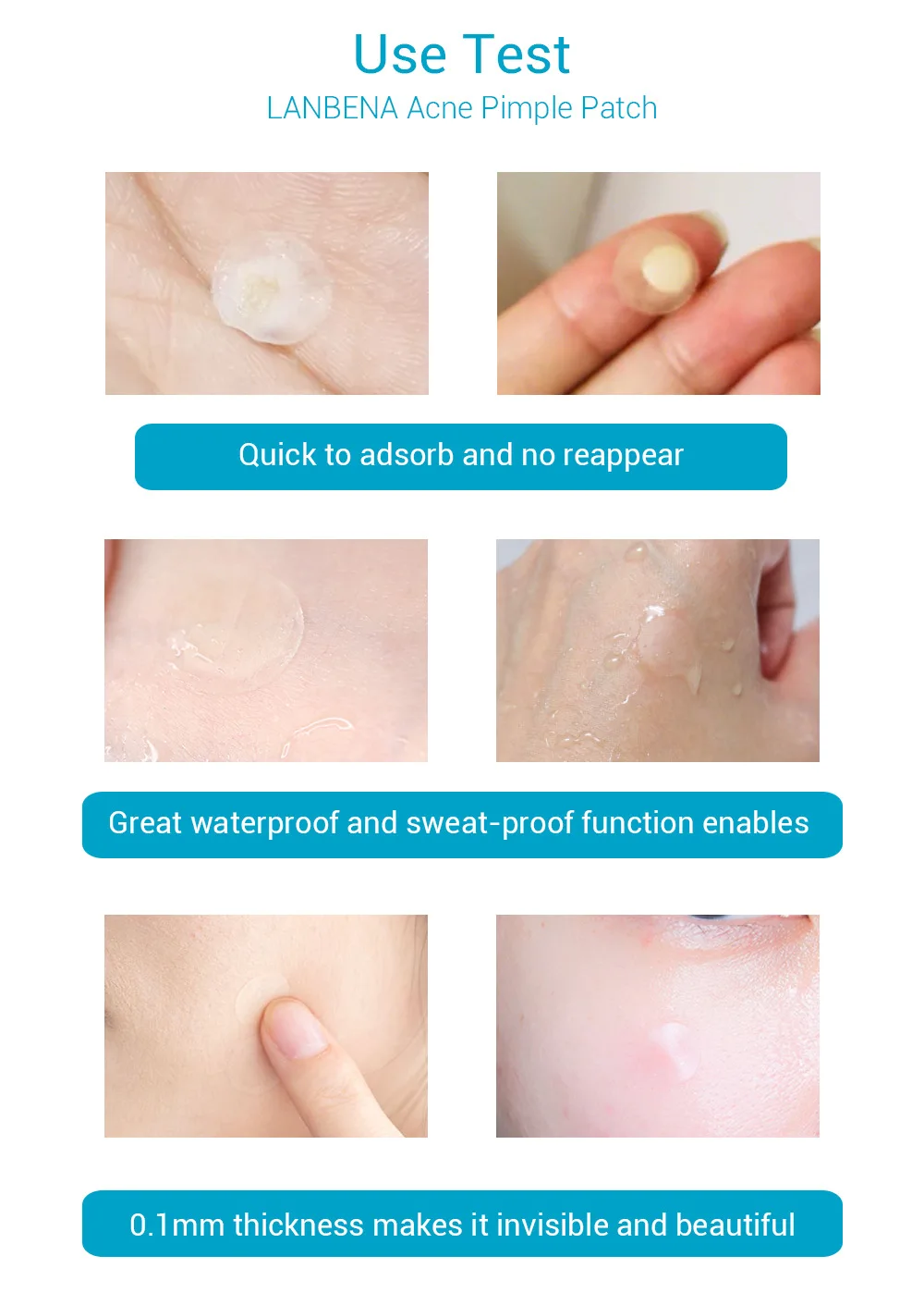 LANBENA ежедневное использование невидимые Прыщи Патчи от акне наклейки лечение