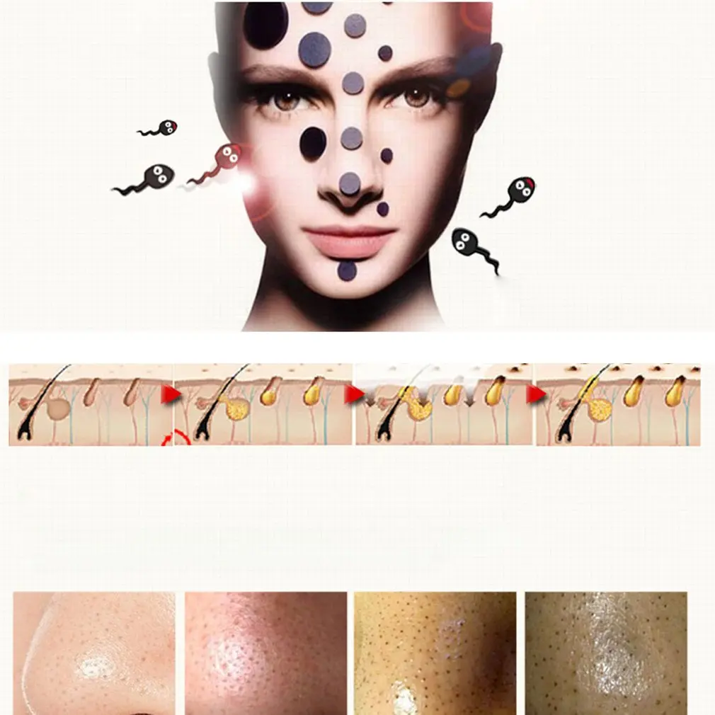 

10ml Blackhead Derivative Liquid Unisex Eliminating Blackhead Essence Shrink Pores Acne Removal Essence