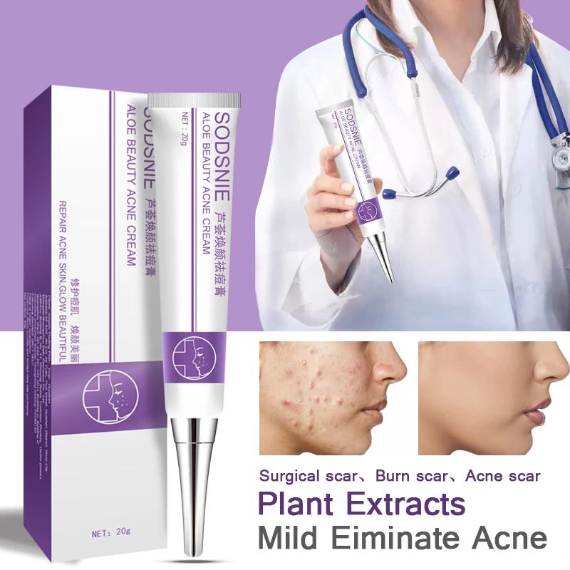

Aloe Acne Removal Cream Acne Pimple Treatment Oil Control Moisturizing Herbal Repair Comedone Remove Scar Gel Face Skin Care 20g