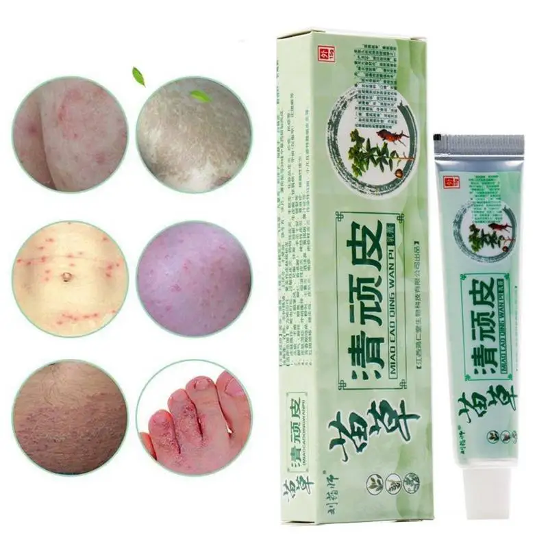 

Chinese Herbal Medicine Skin Cream For Anti-itch Allergies Dermatitis Eczema Pruritus Psoriasis Ointment External Use Plaster