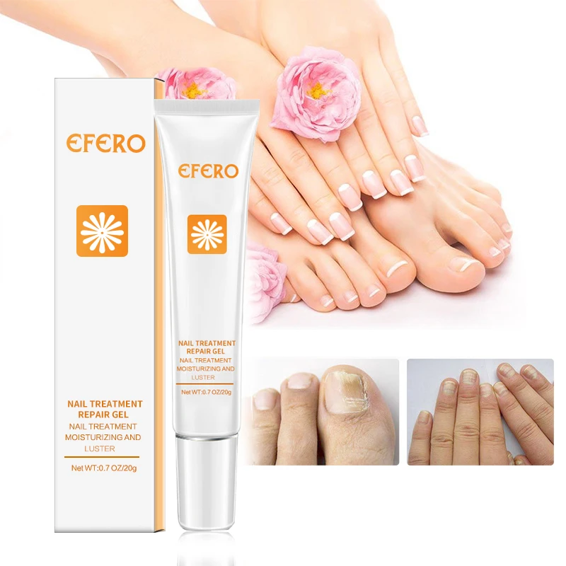 Восстанавливающая эссенция для ногтей, сыворотка для удаления грибков, онихомикоз, против грибковой инфекции ногтей, крем для ухода за кожей, Питательный Уход за ногтями EFERO